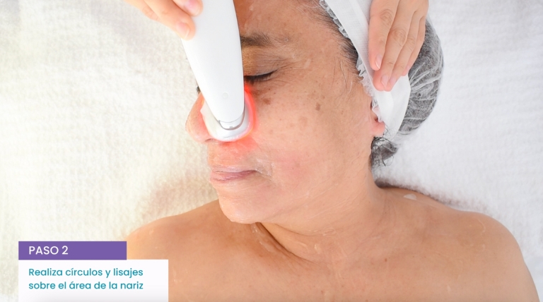 Electroestimulación facial en la zona de la nariz y las mejillas