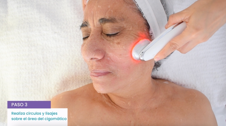 Técnica profesional de microestimulación facial sobre el rostro