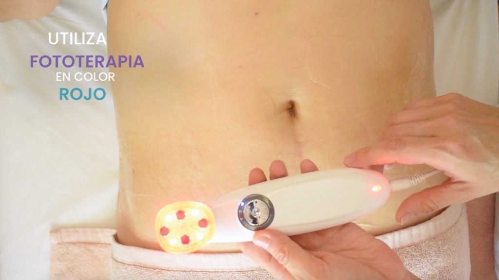 Aparatología estética utilizada para tonificar y moldear el abdomen sin cirugía.
