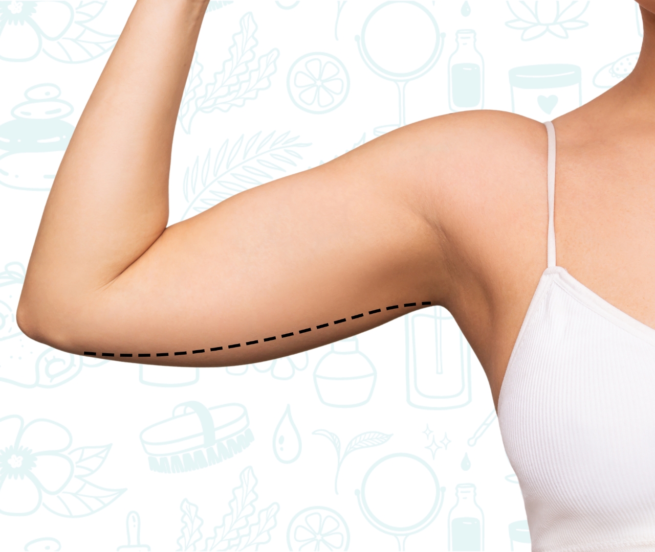 Primer plano de un brazo tonificado después de un tratamiento de electroestimulación efectivo.