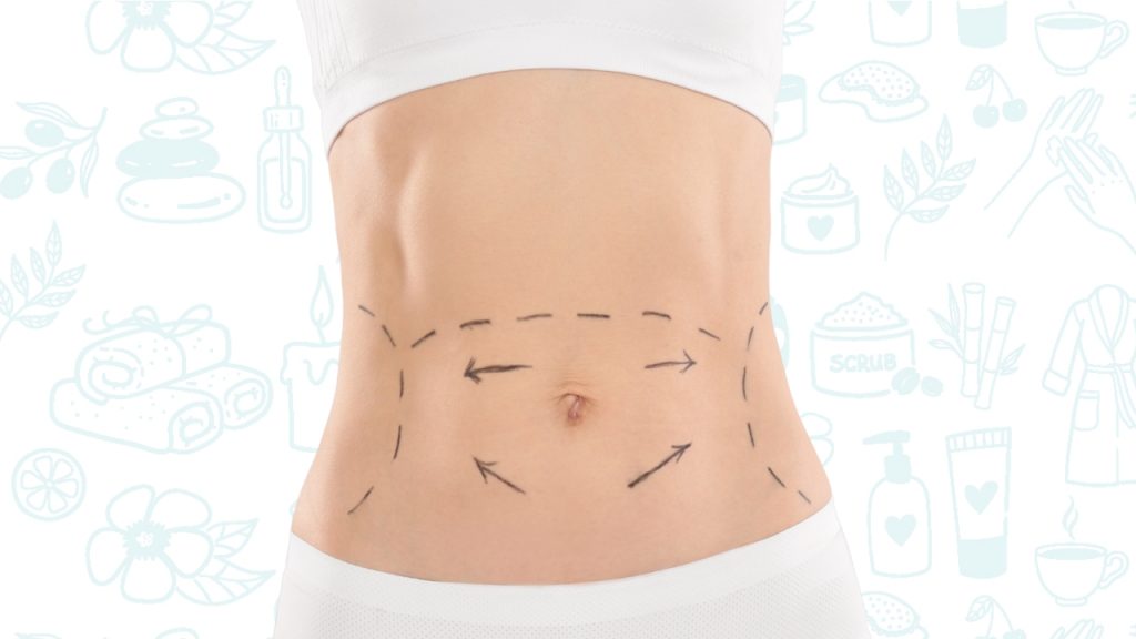 Técnica de reducción de medidas abdominales con electroestimulación en spa.