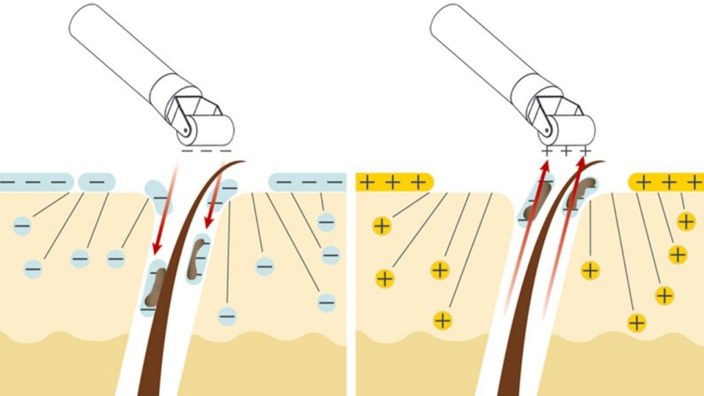 Interacción de iones durante la penetración de activos con corriente galvánica.