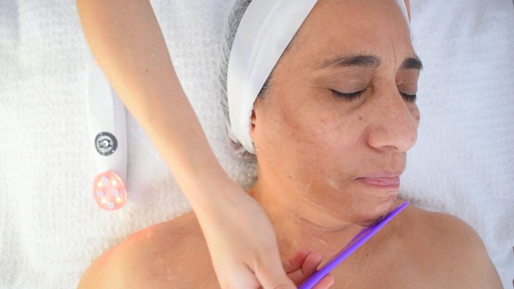 Técnica de microestimulación aplicada en el mentón y maxilar inferior.