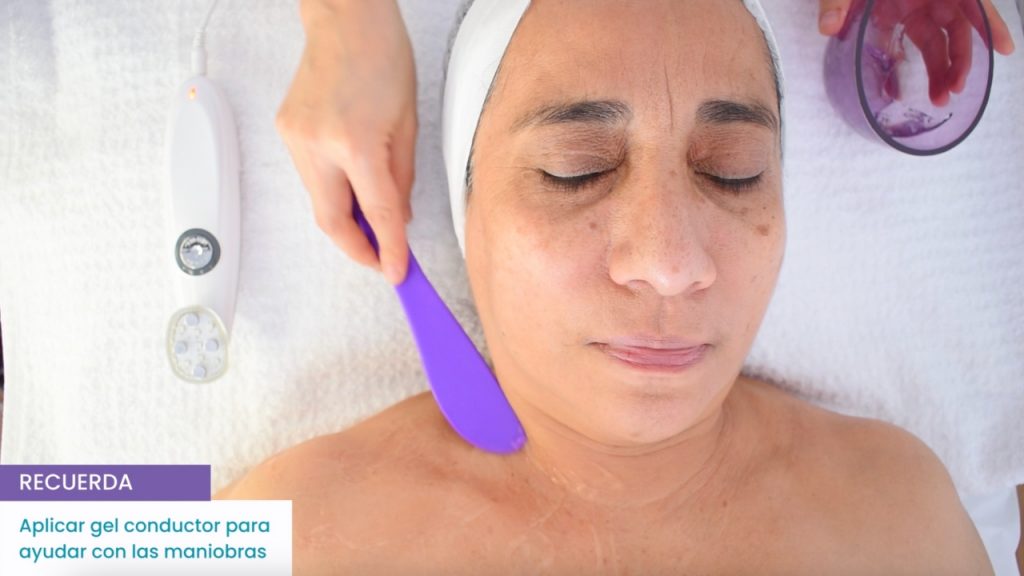 Zonas del rostro recomendadas para aplicar microestimulación facial.