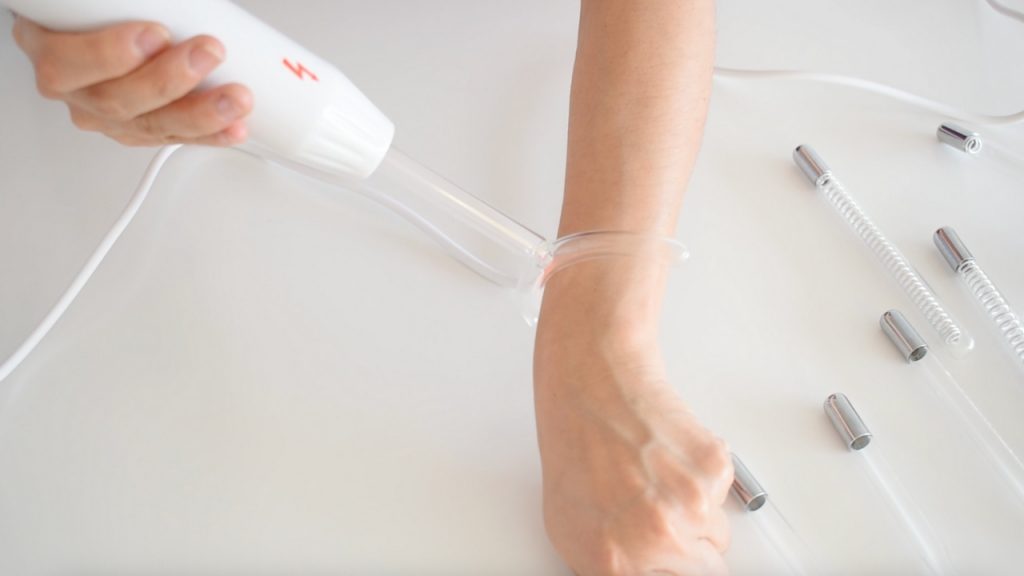 Uso del electrodo horquilla en técnica de chisporroteo sin contacto con la piel.