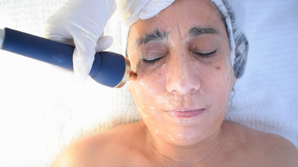 Zonas del rostro donde se puede aplicar el ultrasonido facial de forma segura.
