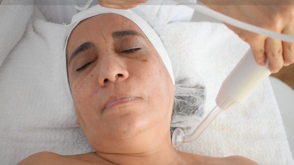 Generación de ozono con alta frecuencia facial durante la técnica de chisporroteo.