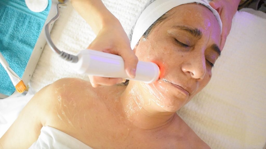 Radiofrecuencia facial aplicada en la zona mandibular para definir el óvalo facial y estimular colágeno.