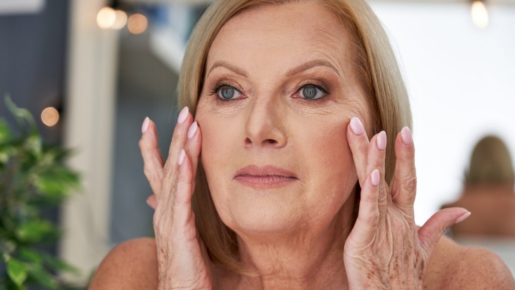 Mujer con piel madura mostrando signos de flacidez y arrugas antes del tratamiento de radiofrecuencia facial