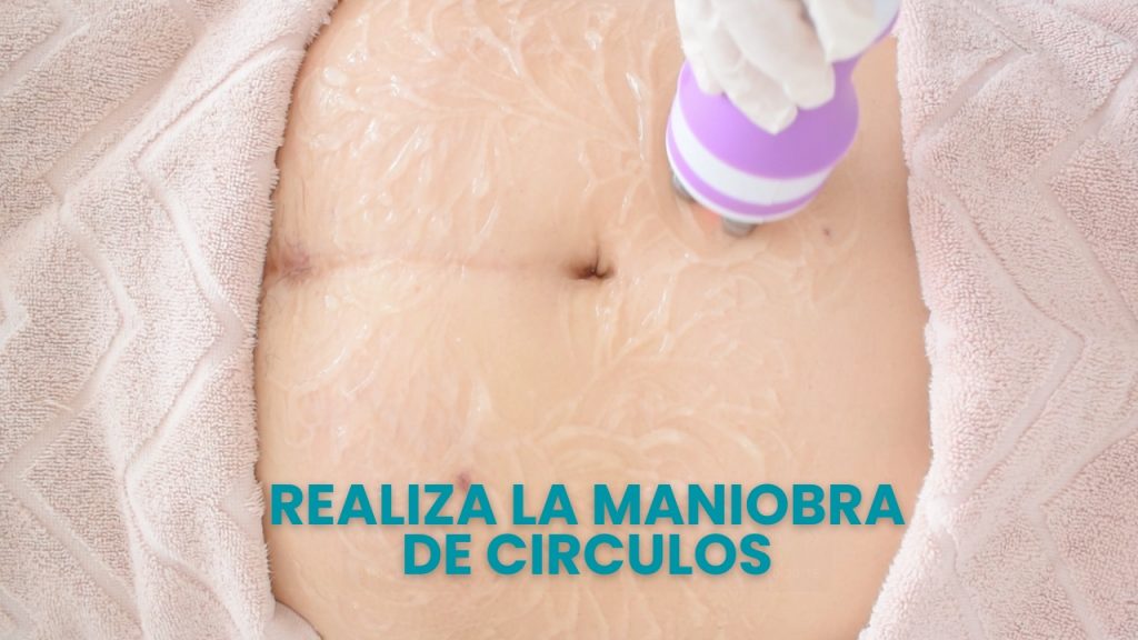 Técnica de movimientos circulares durante la aplicación de radiofrecuencia en el abdomen.