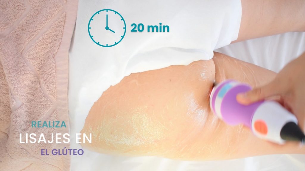 Indicador visual del tiempo recomendado para tratamiento de radiofrecuencia en glúteos.