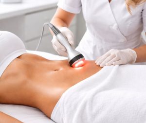 Tratamiento profesional de radiofrecuencia corporal aplicado en el abdomen para reducir flacidez y mejorar la cintura.
