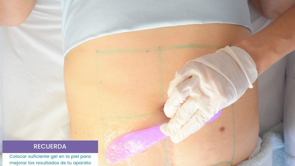 Aplicación de gel conductor en cuadrante abdominal antes de maniobra con ultrasonido