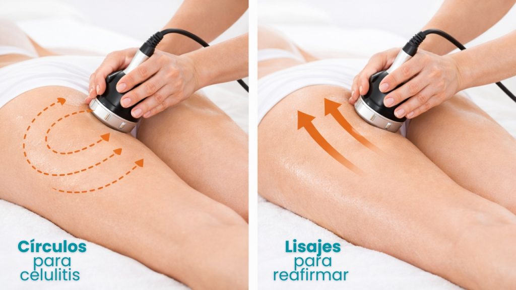 Maniobras de radiofrecuencia corporal en piernas con movimientos circulares y lisajes para mejorar celulitis y flacidez