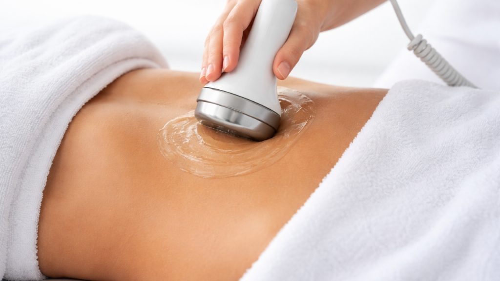 Aplicación de gel conductor antes del tratamiento de ultrasonido en abdomen con estrías