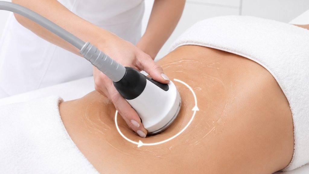 Movimientos circulares, en espiral y lisaje durante la radiofrecuencia abdominal.