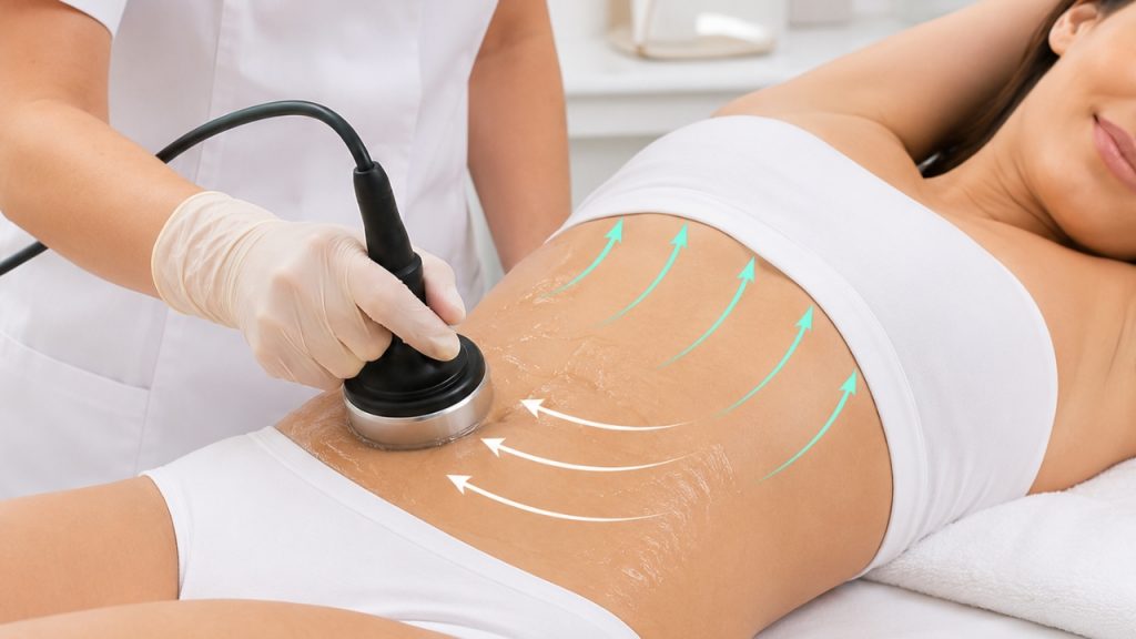 Movimientos del maneral para trabajar la cintura con radiofrecuencia abdominal.