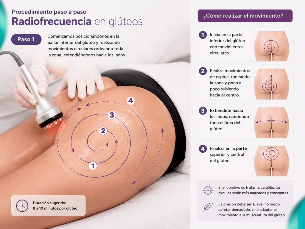 Técnica efectiva para moldeado y reafirmación de glúteos con radiofrecuencia.