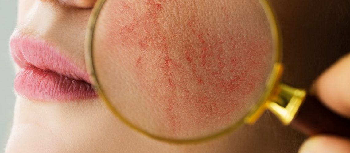 Consejos para el cuidado de la piel sensible